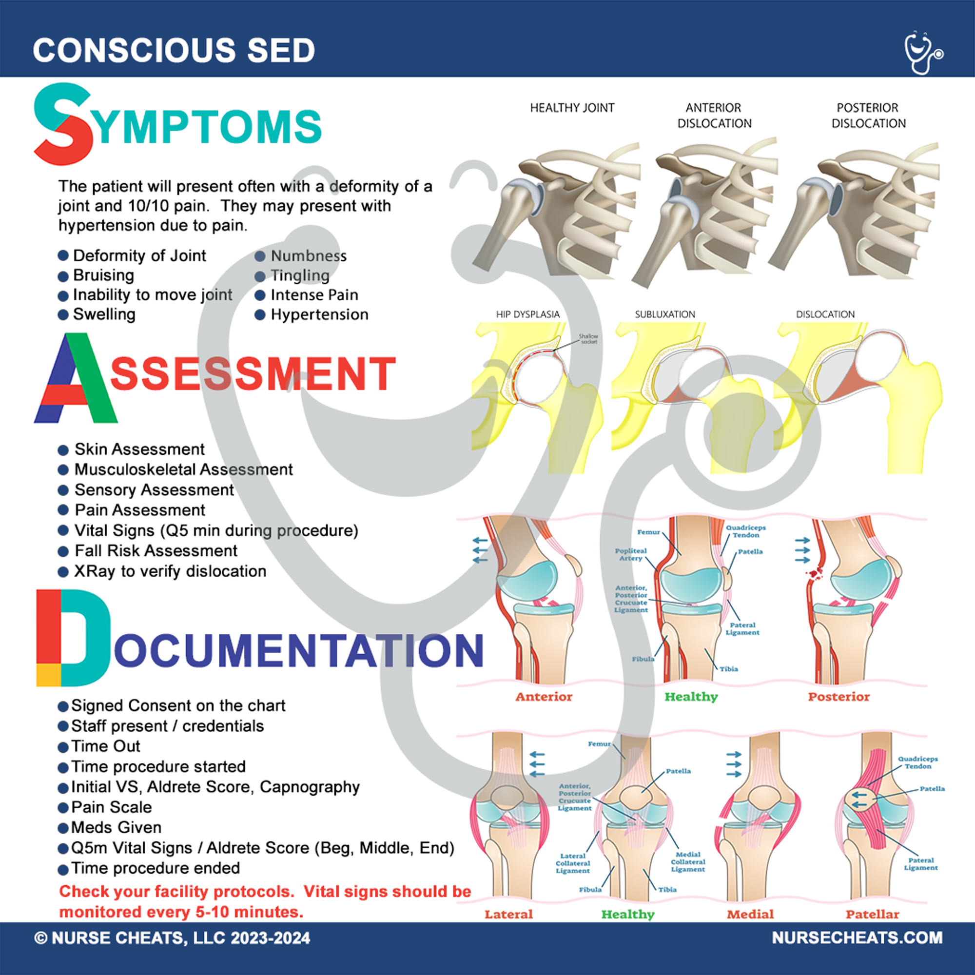 Side 1 of our Conscious Sedation badge buddy contains symptoms, assessment, and documentation for nurses.