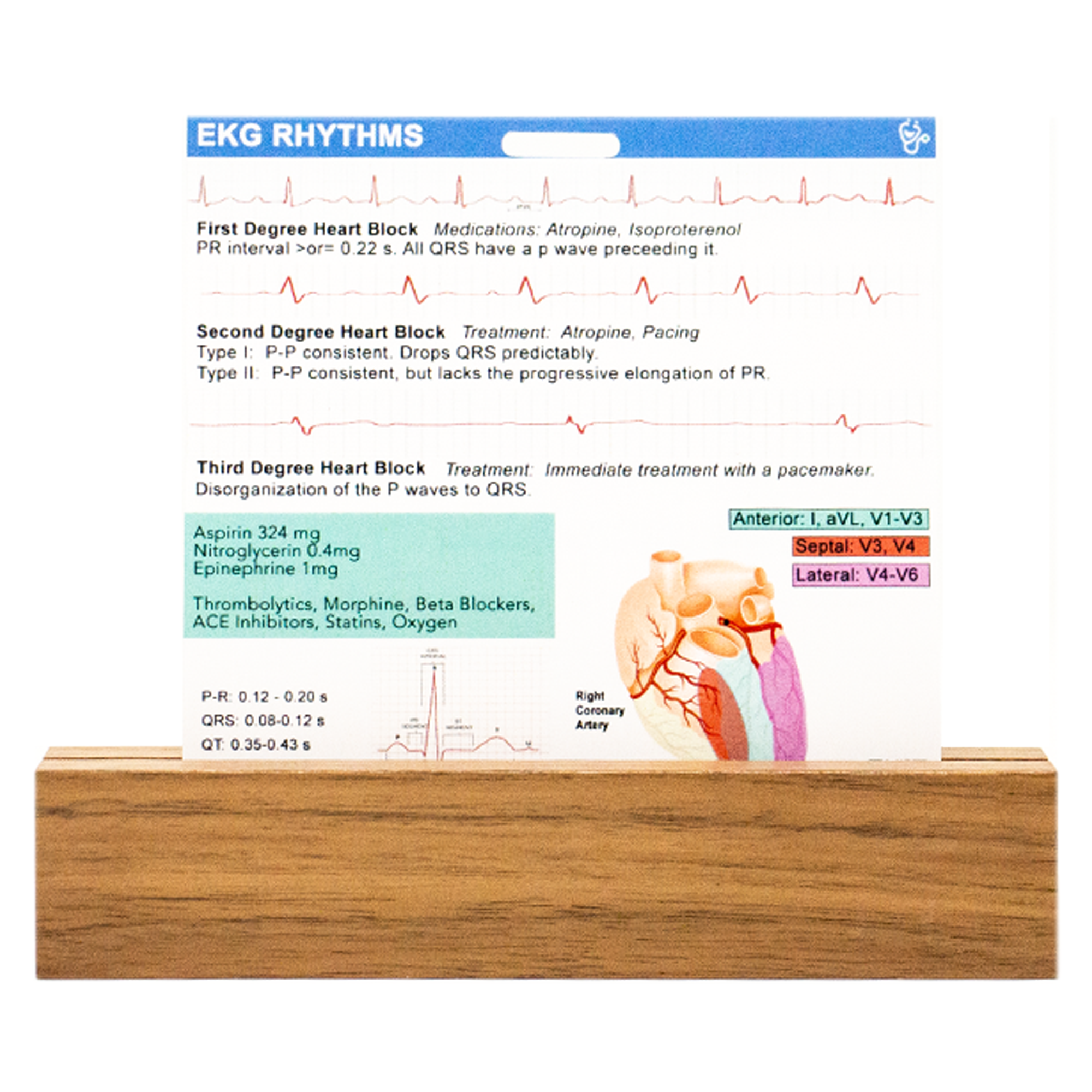 Side 2 of our EKG badge buddy contains lead vs infarction area, EKG times, and heart blocks