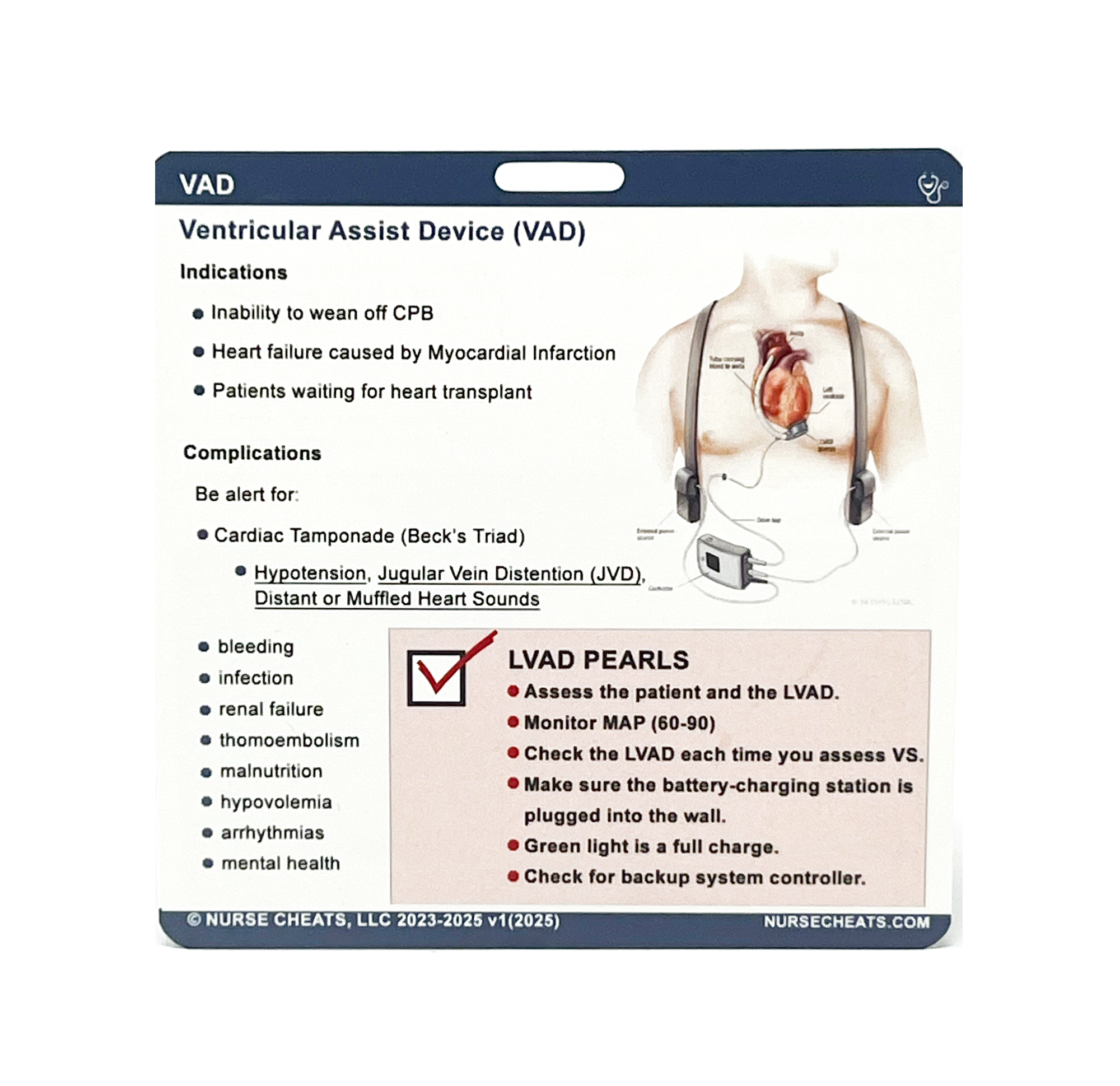 This image shows an LVAD badge buddy, a handy tool for nurses and other healthcare providers to quickly access essential information about Left Ventricular Assistive Devices at the point of care.