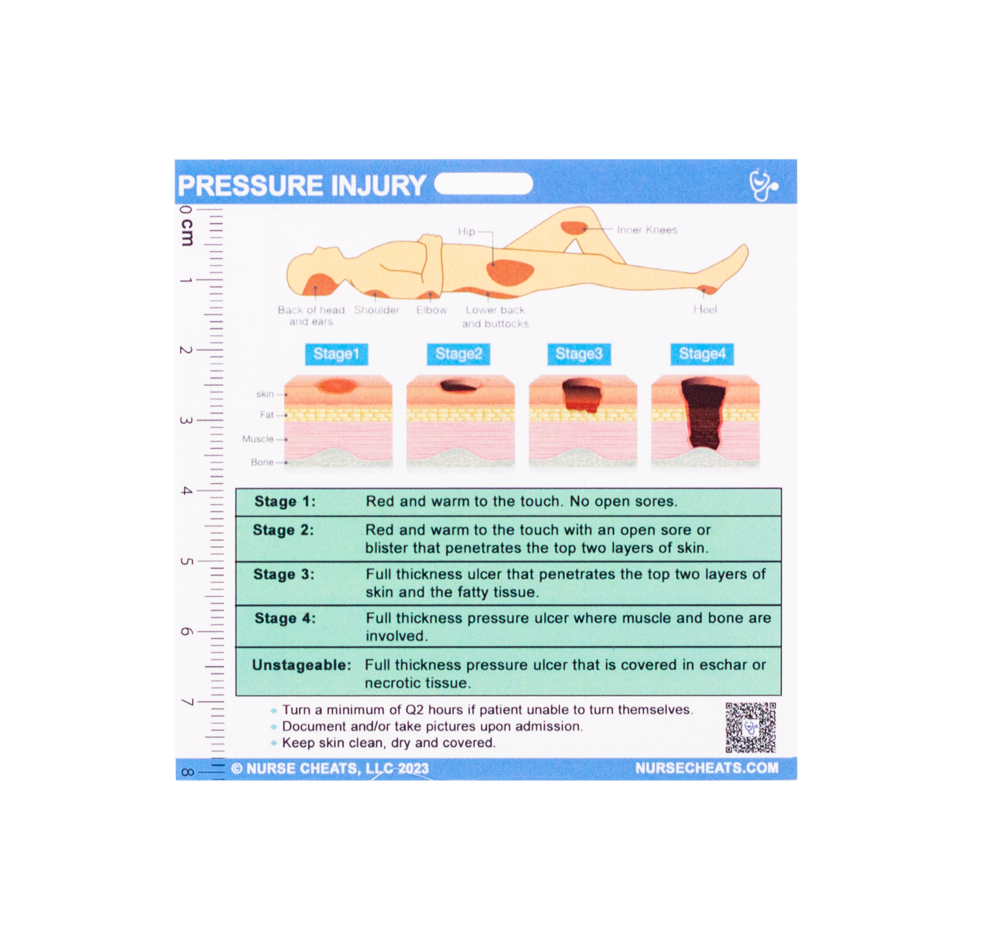Side two of our Wound care badge buddy contains pressure injury classification as well as staging.