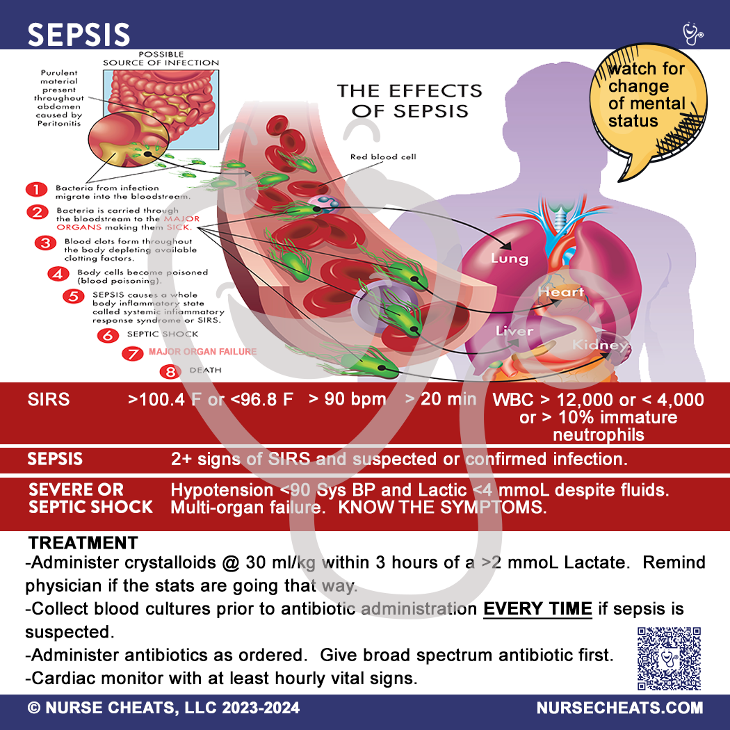 This image shows a NurseCheats.com Sepsis Badge Buddy, a practical tool designed to give nurses and other healthcare providers quick access to crucial sepsis information at the point of care, aiding in early identification and timely intervention.