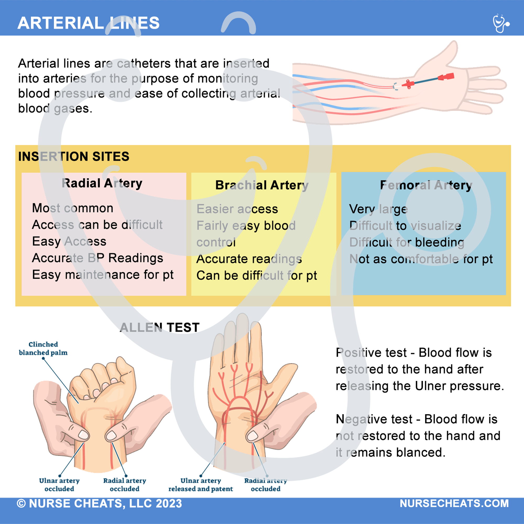 Side 1 of our Arterial Lines Badge Buddy contains Radial Artery, Brachial Artery, Femoral Artery, and the Allen Test.