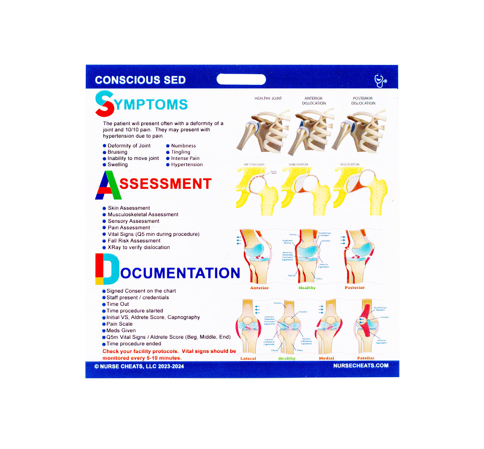 Side 1 of our Conscious Sedation badge buddy contains symptoms, assessment, and documentation for nurses.