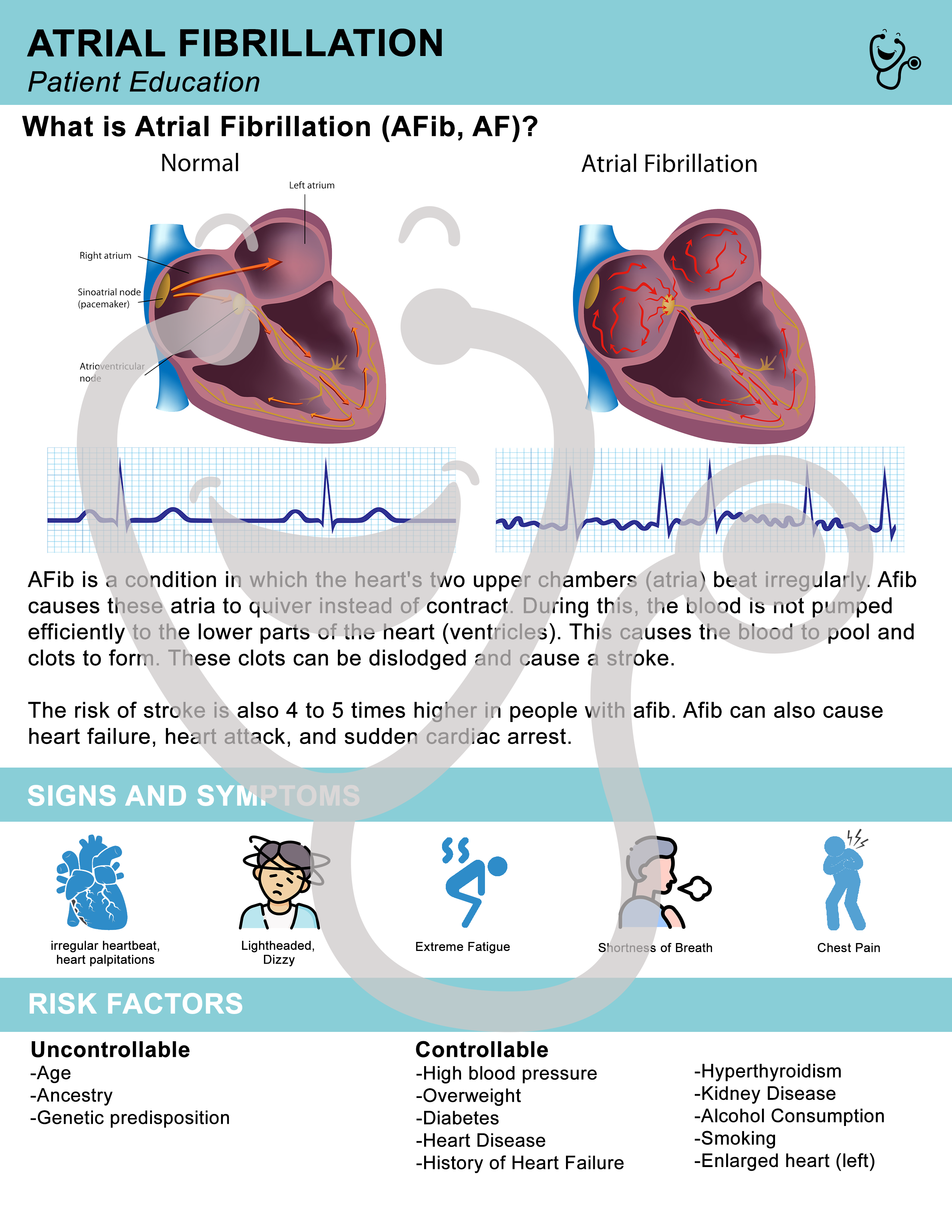 Patient Education - Atrial Fibrillation